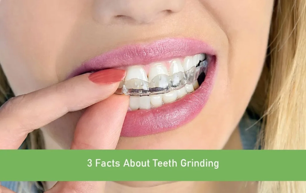 Teeth Grinding